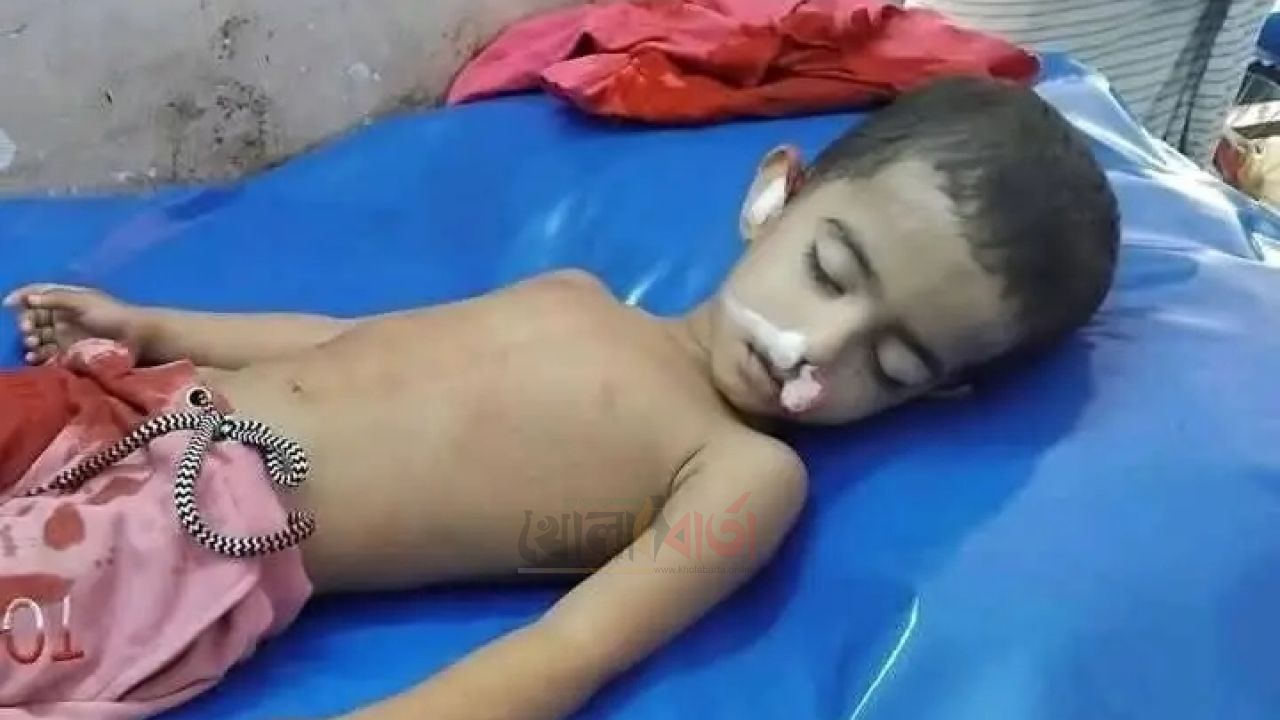 কুমিল্লায় এসিল্যান্ডের গাড়িচাপায় দুই বছরের শিশুর মর্মান্তিক মৃত্যু 