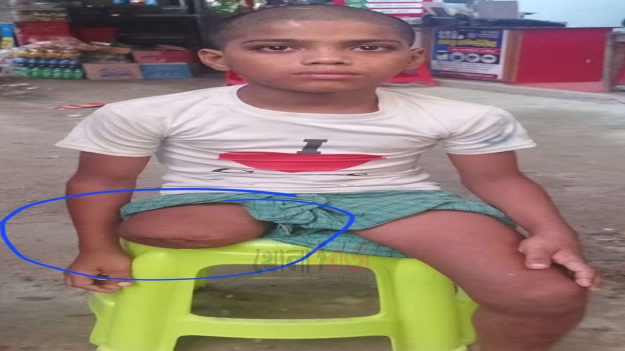 পা কেটে ভিক্ষাবৃত্তিতে বাধ্য করার অভিযোগ, ৭ মাস পর বাবার দেখা পেল রায়হান