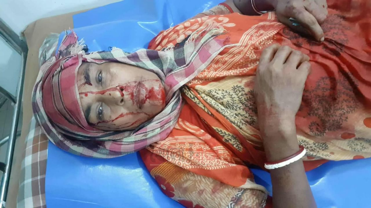 সলঙ্গায় শিশুকে কেন্দ্র করে দুই নারীকে মারধরের অভিযোগ, আহত ১