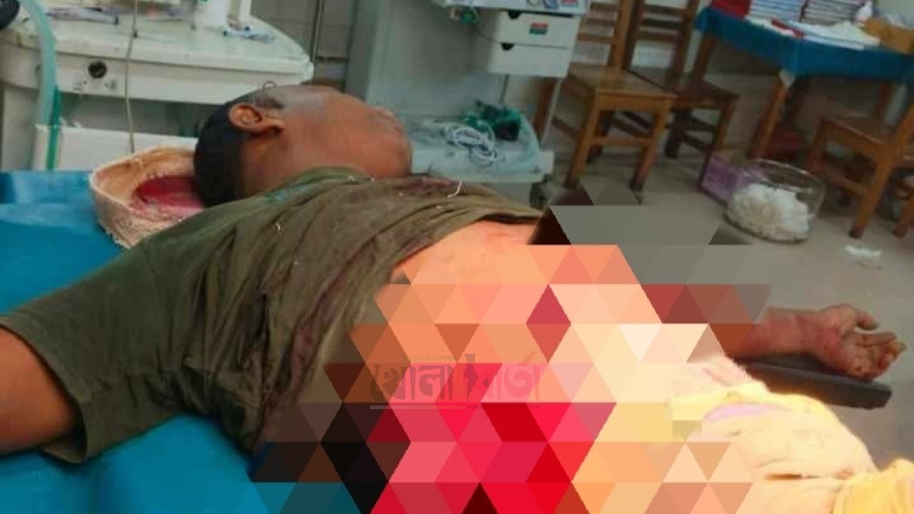 ধুনটে ছুরিকাঘাতে গুরুতর আহত তুলসী রায়, আইসিইউতে ভর্তি